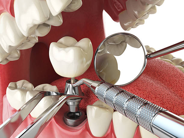 Best Broken or Cracked Tooth Emergency Dentist in Lihue, HI